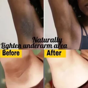 Whitening Cream Private Parts Underarm Bleaching Serum Whiten Butt Knee Brighten Inner Thigh Intimate Parts Dark Remove Melanin - Image 3