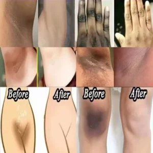 Whitening Cream For Dark Skin Underarm Bleaching Armpit Lightening And Intimate Area Woman Moisturizer Korean Skin Care Products - Image 3