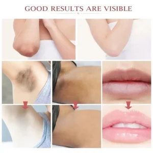 Whitening Cream For Dark Skin Underarm Bleaching Armpit Lightening And Intimate Area Woman Moisturizer Korean Skin Care Products - Image 5