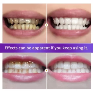 BREYLEE Pearl Teeth Whitening Tooth Powder Fresh Breath Stain Removal Gentle Cleansing Foam Oral Cleansing Care 30g - Image 5
