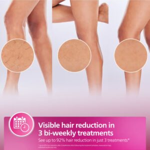 Philips Lumea IPL, Hair Removal, 9000 Series, SenseIQ Technology, 4 Attachments, Face, Body, Bikini, Underarm, Cordless Use, BRI958/60, Rose Gold, 60 Days Money Back Guarantee Pink - Image 8