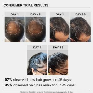 Advanced Hair Growth Serum | 3% Redensyl + 4% Anagain + 3% Baicapil + 1% Capilia Longa, Rosemary, Biotin & Rice Extract | Hair growth & Hair fall control serum for Women & Men | 30mL - Image 5