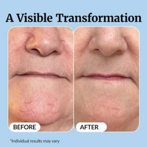 Vibriance Super C Serum for Mature Skin - All-in-One Vitamin Formula Hydrates, Firms, Lifts, Smooths, Targets Age Spots, Wrinkles, 1 fl oz - Image 4