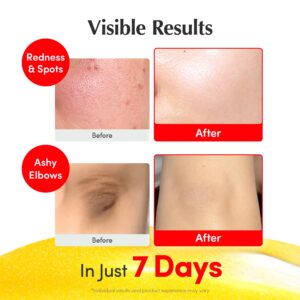 EQQUALBERRY Vitamin Illuminating Serum | Niacinamide 4% + Brightening Vitamin C Face Serum with Hyaluronic Acid & Vitamin E | Dark Spot, Uneven Tone Care | Korean Skincare, 1.01 fl.oz - Image 7