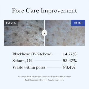 Medicube Zero Pore Blackhead Mud Facial Mask - Skin Cooling & Pore Tightening - 3 Minute Quick Dry Formula with AHA, BHA, PHA, and Pore-Purifying Clay - Korean Mud Mask 3.52 oz - Image 4