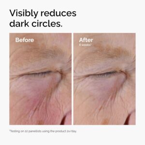 The Ordinary Caffeine Solution 5% + EGCG, Depuffing Eye Serum for Dark Circles and Tired Eyes - Image 4