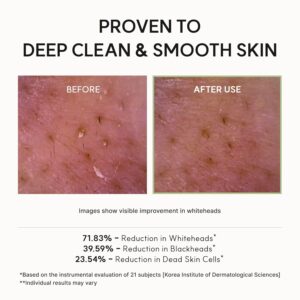 Arencia Korean Rice Mochi Face Cleanser - Face Wash, Gentle Scrub All in One for Deep Cleansing, Moisturizing, Pore Minimizing, Acne-Prone Skin, Removing Blackhead with Rice Water & Green Tea - Image 7