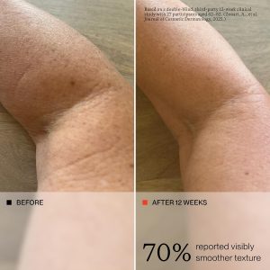 oneskin OS-01 FACE & BODY | Age Reversal Moisturizer, 2-Piece Set OS-01 peptide routine targets root causes of skin aging. Improves hydration, firmness, elasticity, texture & fine lines - Image 5