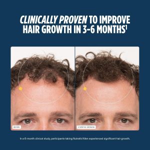 Nutrafol Men Hair Growth Supplements, Ages 18-49 - Image 9
